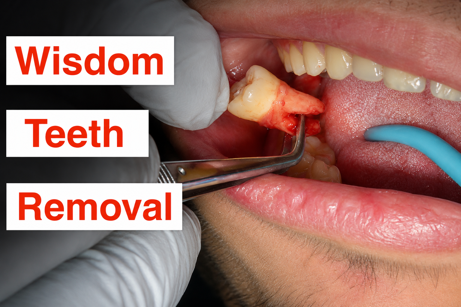 Oral Surgery