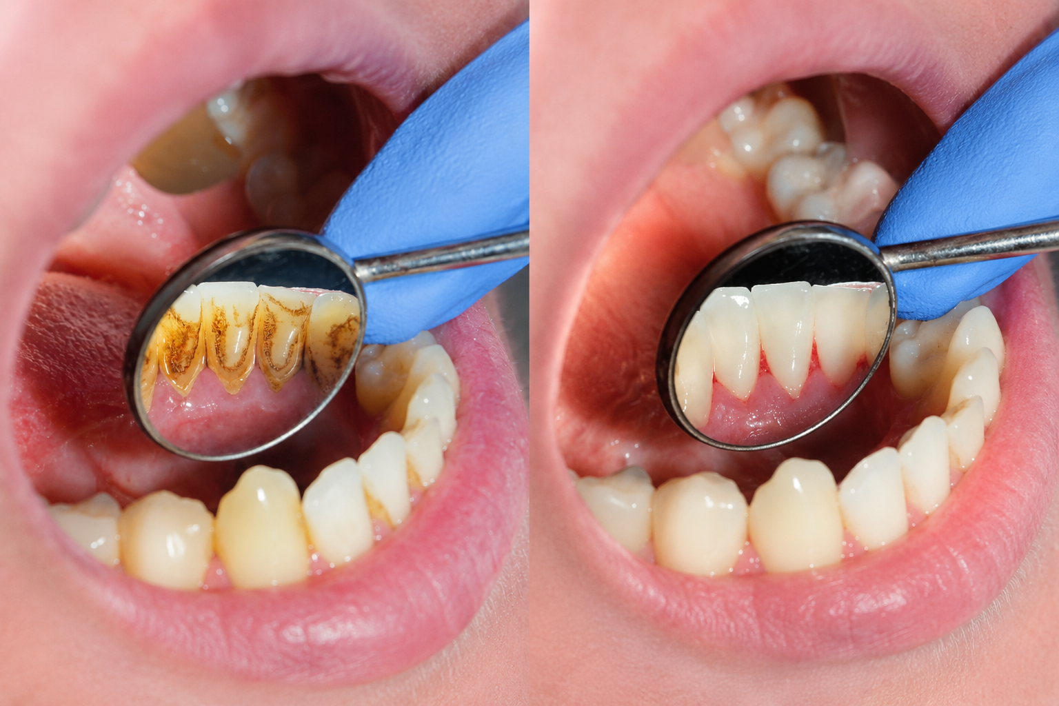 Periodontology